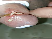 Pain cbt insertion bdsm pervers maggots