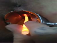 BBW Freak Opens Wide to Have Her Cervix Sounded 