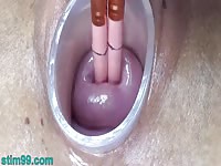 German Lesbian threesome Cervix play and peehole