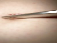 teen cuts herself while using vibration